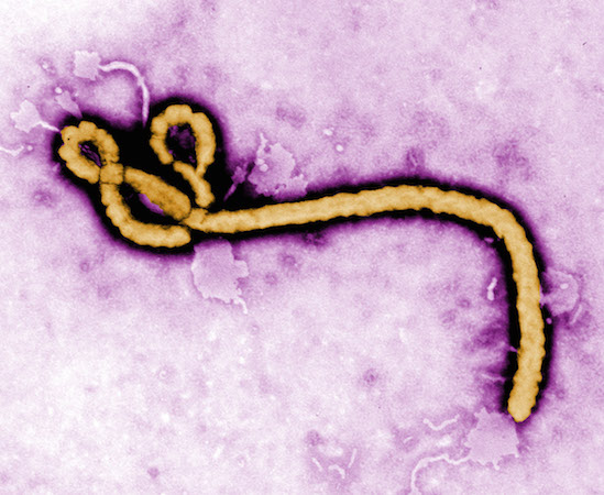 O ebola é a doença mais letal que a humanidade já conheceu: entre 50% e 90% dos infectados morre. O vírus causador ataca as células do fígado, baço, pulmão e tecido linfático, além de destruir as células endoteliais dos vasos sanguíneos, causando hemorragias internas e externas. (Foto: Getty Images)