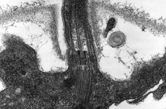 Citosol? Sim, o líquido que preenche o citoplasma. Contêm moléculas de água, íons, aminoácidos e enzimas que têm papel na síntese e degradação de carboidratos, ácidos graxos, aminoácidos e outras substâncias. (Foto: Creative Commons)