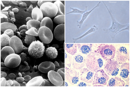 As principais células conjuntivas são os fibroblastos (produzem a substância intercelular), os macrófagos (combate microorganismos invasores através da fagocitose), os mastócitos (contêm heparina, um anticoagulante, e histamina, que é liberada em casos de reação alérgica), os plasmócitos (produzem anticorpos), os adipócitos (armazenam lipídios, ou seja, gordura) e os leucócitos ou glóbulos brancos (células que realizam defesa). A foto mostra, no sentido horário, fibroblastos, mastócitos e leucócitos (em meio a glóbulos vermelhos e plaquetas). (Imagens: Wikimedia Commons)
