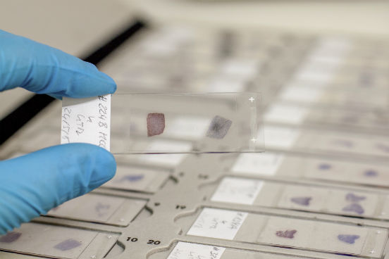 Esses profissionais, que preparam lâminas com material histológico de tecidos, que são examinadas através de microscópios, por patologistas, podem estar expostos a condições perigosas de trabalho, a contaminantes e a doenças e infecções. O faz com que essa profissão seja a sétima mais insalubre. (Imagem: Thinkstock) Esses profissionais, que preparam lâminas com material histológico de tecidos, que são examinadas através de microscópios, por patologistas, podem estar expostos a condições perigosas de trabalho, a contaminantes e a doenças e infecções. O faz com que essa profissão seja a sétima mais insalubre. (Imagem: Thinkstock)