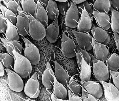 A Giardíase é uma infecção intestinal causada pelo protozoário Giardia lamblia. Na forma de cisto, causa diarreia crônica com cheiro forte, fraqueza e cólicas abdominais, podendo acarretar deficiência vitamínica e mineral e levar crianças à morte. Ocorre em todo o mundo, mas é mais comum em áreas onde o saneamento básico e as condições de higiene são precárias. (Foto: Creative Commons) A Giardíase é uma infecção intestinal causada pelo protozoário Giardia lamblia. Na forma de cisto, causa diarreia crônica com cheiro forte, fraqueza e cólicas abdominais, podendo acarretar deficiência vitamínica e mineral e levar crianças à morte. Ocorre em todo o mundo, mas é mais comum em áreas onde o saneamento básico e as condições de higiene são precárias. (Foto: Creative Commons)