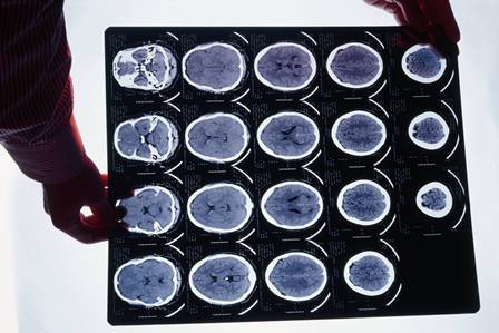 Medicina da USP oferece pós-doutorado em Neuroimagem