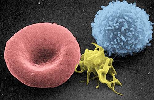 UFF inscreve para pós-graduação em Hematologia Clínica