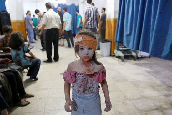 Garota síria ferida em bombardeio das forças do governo sírio recebe tratamento em um hospital improvisado na cidade de Douma, controlada pelos rebeldes, na Síria (Crédito foto: Abd Doumany/Agence France Presse). Garota síria ferida em bombardeio das forças do governo sírio recebe tratamento em um hospital improvisado na cidade de Douma, controlada pelos rebeldes, na Síria (Crédito foto: Abd Doumany/Agence France Presse).