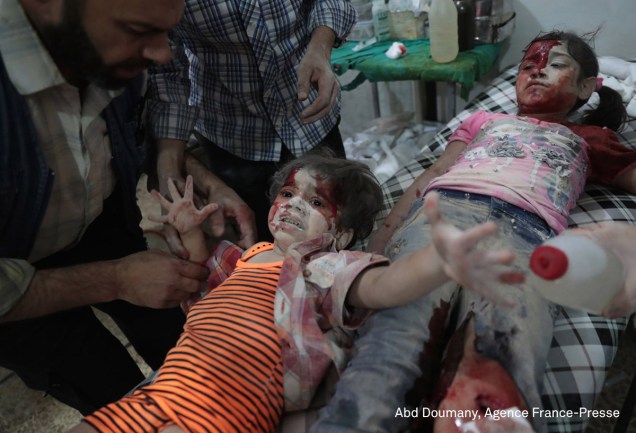 Garota síria recebe tratamento em um hospital em Damasco, na Síria, em setembro de 2016. Ela foi ferida após um ataque aéreo das forças do governo no leste da cidade, em uma região que é controlada pelos rebeldes.
<div id="desc-default"><span>(foto: Abd Doumany/World Press Photo 2017)</span></div>