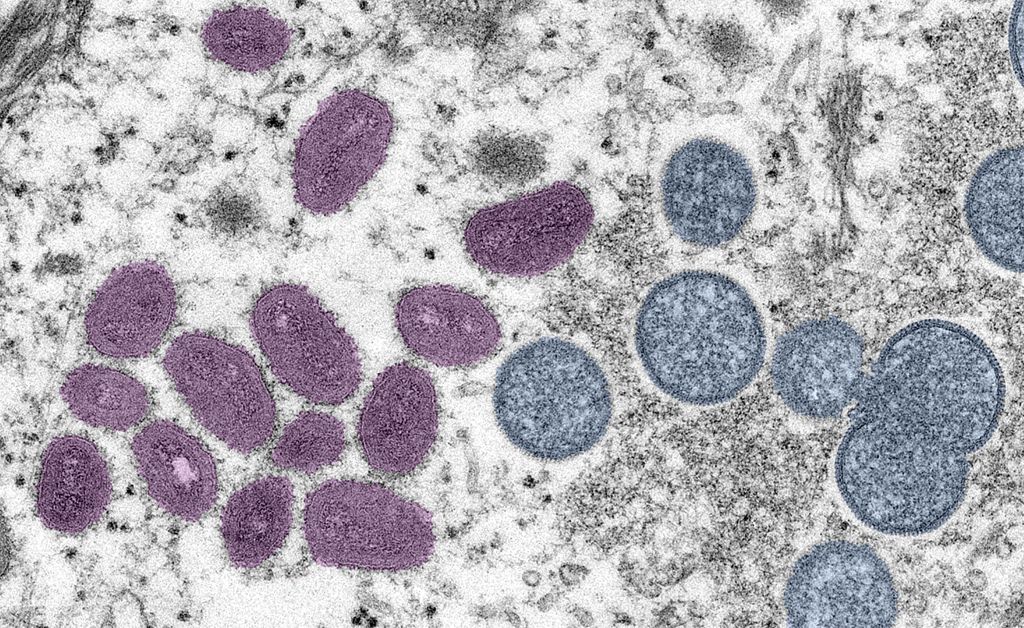 vírus varíola dos macacos no microscópio