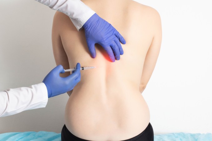 The doctor injects an ozone-oxygen mixture into the back of a girl to a patient to treat diseases of the spine and relax the muscles of the back. Modern method of ozone therapy, thoracic spine