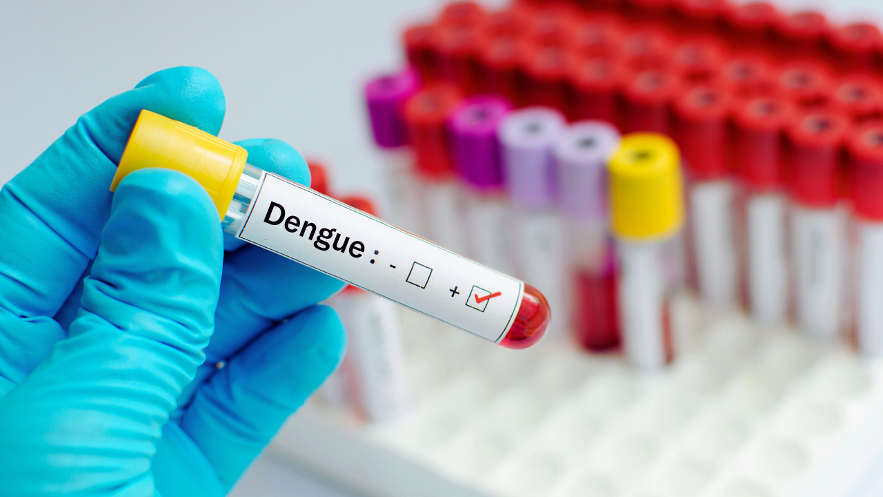 Amostras de sangue com diagnostico da dengue