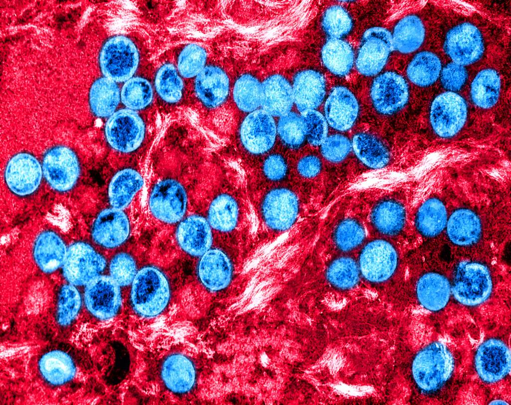 Mpox: entenda a nova doença que ameaça o mundo